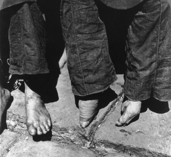 The difference between bound and unbound feet (c. 1902; courtesy of the Library of Congress, LC-USZ62-49138).
