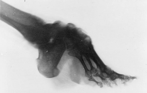 xray2